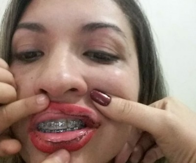 Jornalista posta vídeo em rede social acusando companheiro de violência doméstica