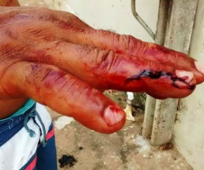 Ao proteger a enteada, padrasto é agredido por jovem no bairro Vila Nova