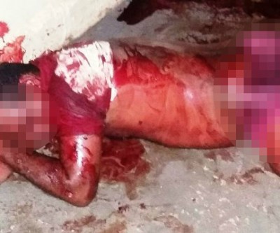 Homem invade a casa da ex e após briga, leva 10 facadas