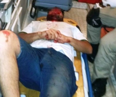 Vereador flagra acidente grave na Ranulpho Marques Leal 