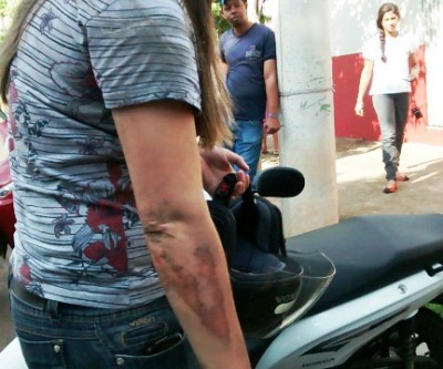 Motociclista sofre escoriações em acidente no Vila Nova