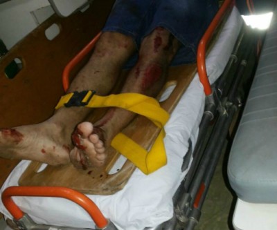 Motociclista fica ferido ao bater em sacos de lixo no Vila Nova