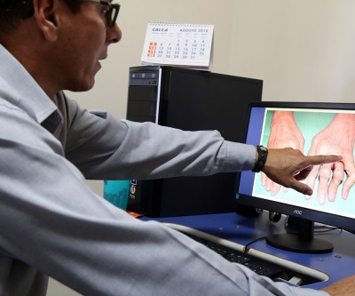 Três Lagoas tem um caso confirmado de febre Chikungunya