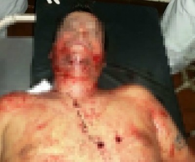 Mais um bandido é morto pela polícia, desta vez, em Caarapó-MS