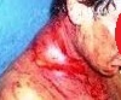 Cliente de bar no Santa Rita apanha e não sabe dizer quem é o acusado das agressões