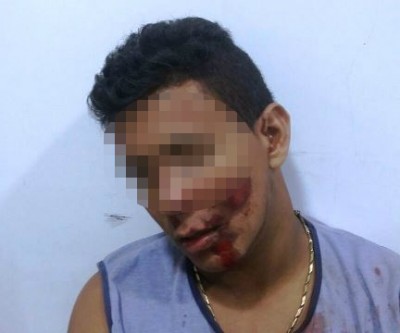Jovem embriagado que sofreu acidente dorme durante o registro da ocorrência 