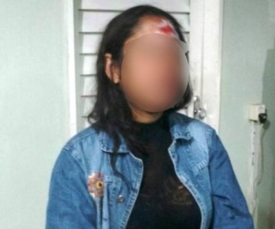 Após agressões, mulher se finge de morta para o marido parar de bater