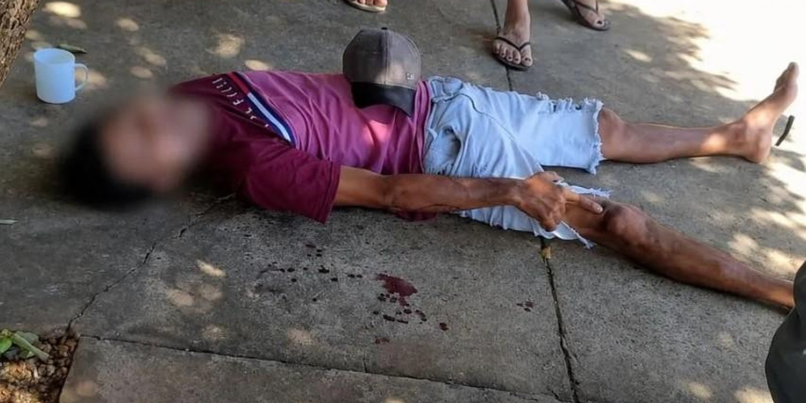 Homem é espancado com pedaço de pau por causa de dívida de R$ 1,2 mil em Três Lagoas