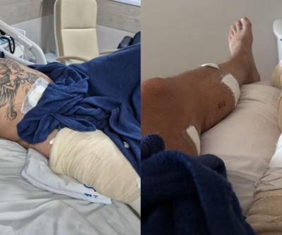 'Me puxou para terminar de me matar', diz vítima que sobreviveu a 14 facadas em MS