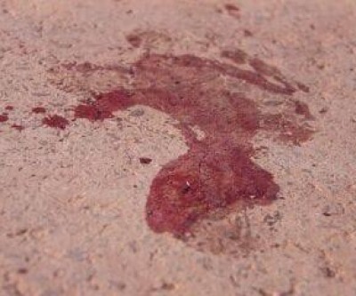 Mulher é morta com golpe de faca pelo companheiro na zona rural de Paranaíba