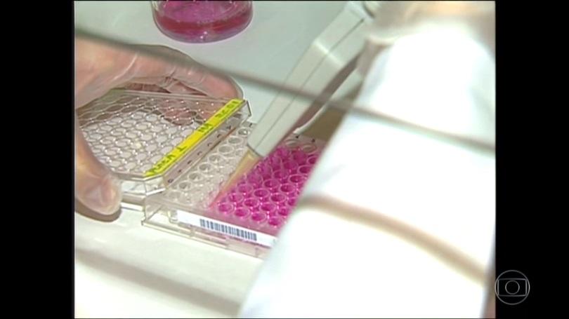 Cientistas relatam segundo caso de cura do HIV após transplante