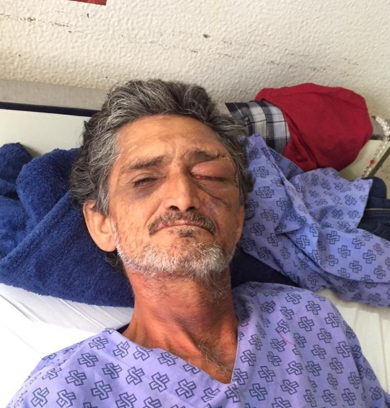 Homem ferido em assalto e levado para Santa Casa de Campo Grande procura por seus filhos