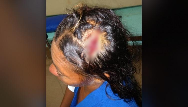 Para escapar de pauladas na cabeça, mulher fica 11 horas escondida do marido em matagal