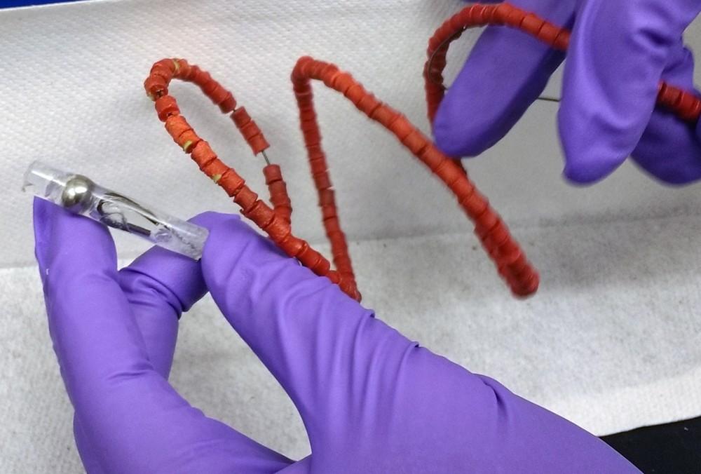 Tuberculose pode ser tratada com 'colar de comprimidos' inserido no estômago de paciente, diz estudo