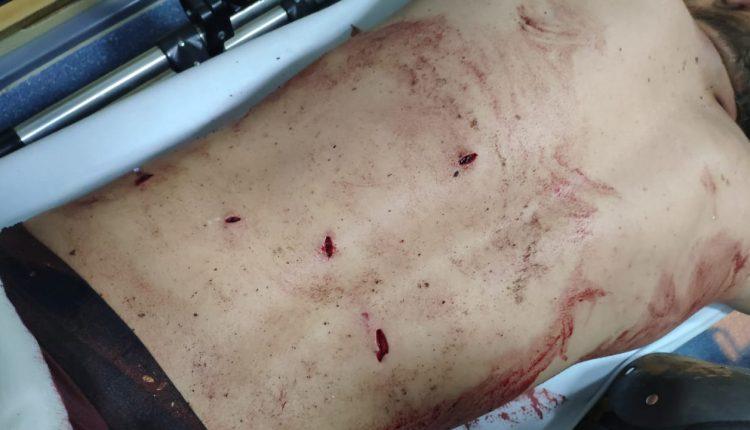 Jovem foi esfaqueado em Chapadão do Sul pelo fato de estar namorando ex-mulher de traficante