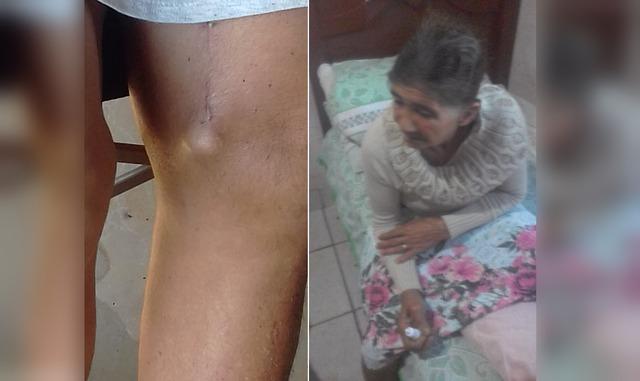 Almoço beneficente busca ajuda para pagar cirurgia de idosa em Três Lagoas Almoço beneficente busca ajuda para pagar cirurgia de idosa em Três Lagoas