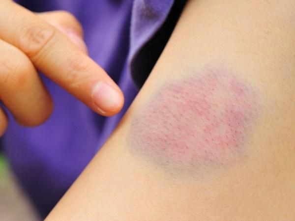 Casos de violência doméstica marcam o fim de semana em Três Lagoas Casos de violência doméstica marcam o fim de semana em Três Lagoas