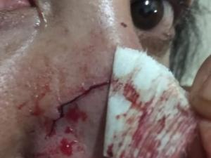 Em Nova Andradina, mulher tem cabelo arrancado e é atropelada pelo marido em discussão Em Nova Andradina, mulher tem cabelo arrancado e é atropelada pelo marido em discussão
