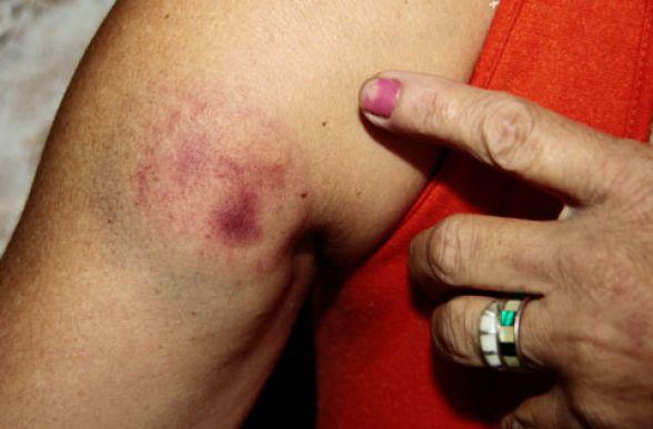 Enciumado e por não atender telefone, homem pula janela e agride a ex que dormia 