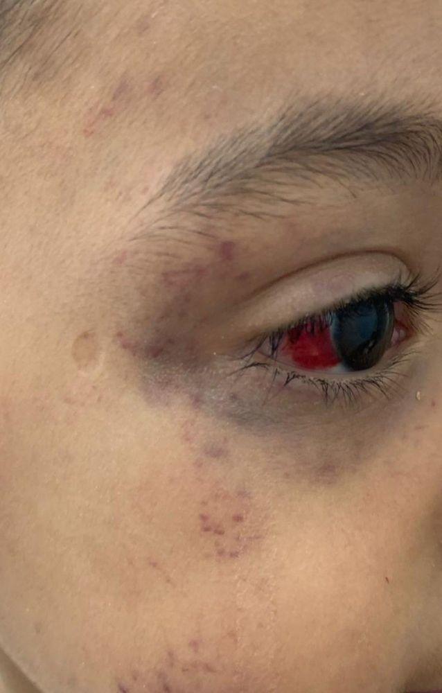 Criança é torturada por 24h com fio de celular pelo padrasto por fazer xixi na cama Criança é torturada por 24h com fio de celular pelo padrasto por fazer xixi na cama