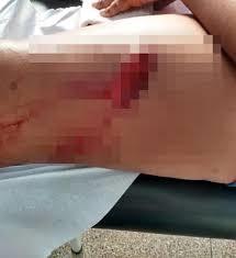 Mãe embriagada dá facada em filha de 10 anos em Araçatuba-SP