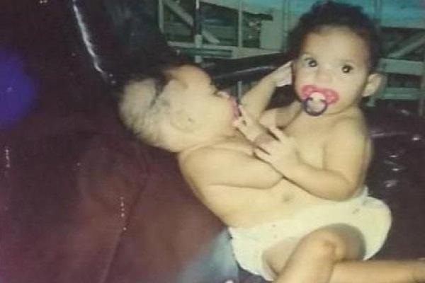 Separadas há 13 anos, siamesas nascidas em Água Clara ainda corrigem a história contada pelos outros Separadas há 13 anos, siamesas nascidas em Água Clara ainda corrigem a história contada pelos outros
