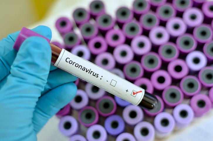 COVID-19 – Três Lagoas chega a 55 casos positivos de Coronavírus, 21 já se recuperaram da doença COVID-19 – Três Lagoas chega a 55 casos positivos de Coronavírus, 21 já se recuperaram da doença