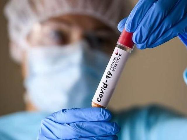 Nenhum novo caso de Coronavírus é registrado nesta quarta-feira em Três Lagoas Nenhum novo caso de Coronavírus é registrado nesta quarta-feira em Três Lagoas