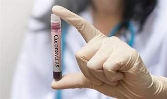 COVID-19:Três Lagoas notifica três casos positivos neste domingo