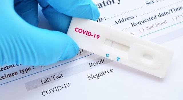 Covid-19: Três Lagoas tem 12 novos casos positivos e mais 21 recuperados nesta terça-feira