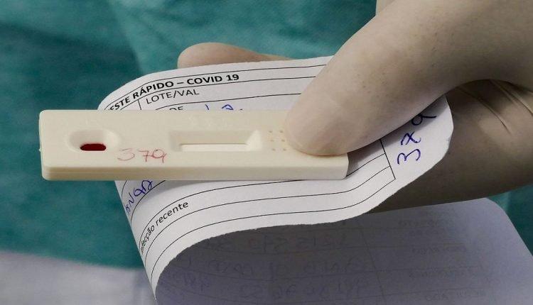 Testes para coronavírus custam até R$ 400 em farmácias e laboratórios de Campo Grande