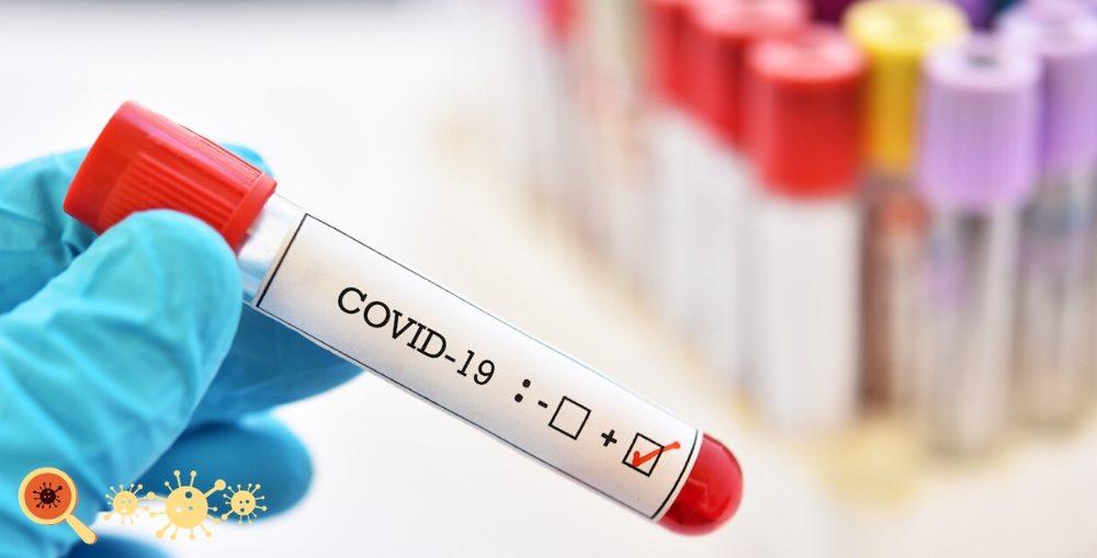 Três Lagoas tem 05 novos casos positivos para o novo coronavírus e chega a 81 ativos da doença Três Lagoas tem 05 novos casos positivos para o novo coronavírus e chega a 81 ativos da doença