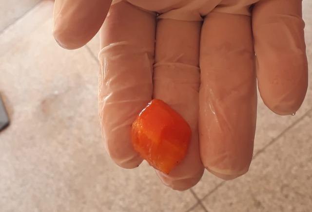 Bebê engasgado com cenoura é salvo por Bombeiros em Três Lagoas Bebê engasgado com cenoura é salvo por Bombeiros em Três Lagoas