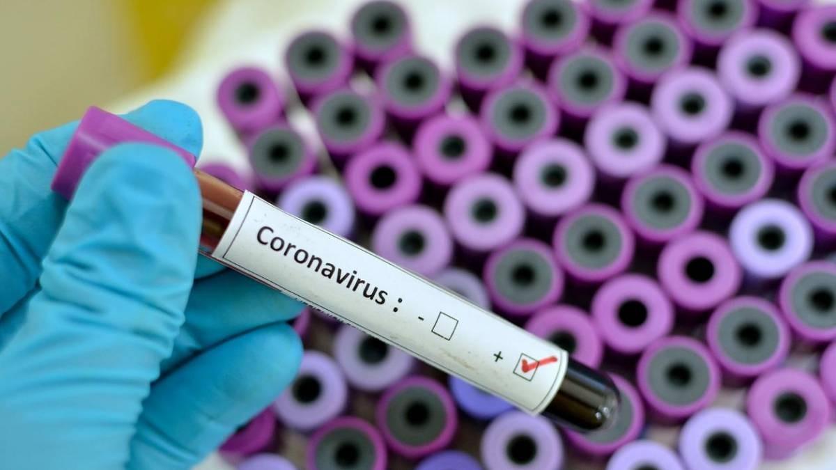 COVID-19: Três Lagoas tem 12 novos casos positivos neste domingo