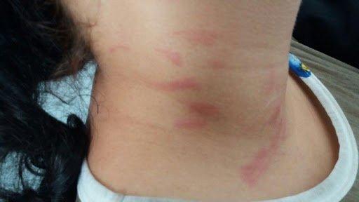 Grávida é agredida por amante do marido ao ver os dois na cama em Campo Grande