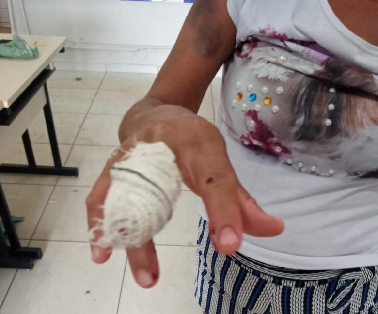 Homem agride esposa com facão e quebra tornozeleira eletrônica da vítima, ameaça vizinhos de morte