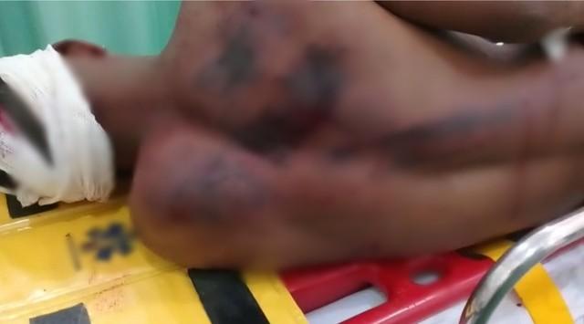 Em Andradina, adolescente é espancado por padrasto ao entrar em briga para defender a mãe Em Andradina, adolescente é espancado por padrasto ao entrar em briga para defender a mãe