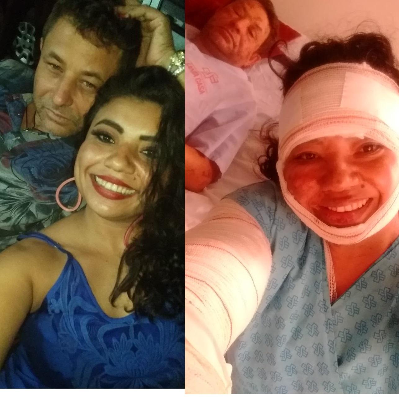 Cantor sertanejo, empresária e vendedora que foram queimados em acidente doméstico foram transferidos para Campo Grande Cantor sertanejo, empresária e vendedora que foram queimados em acidente doméstico foram transferidos para Campo Grande