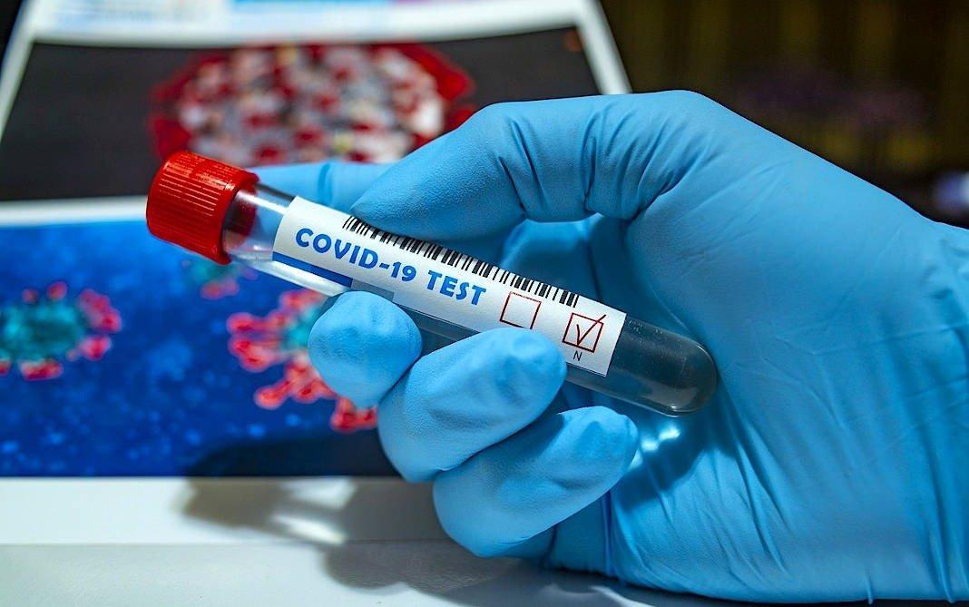 Devido à instabilidade no E-SUS, não foi possível registrar possíveis novos casos positivos para Covid-19 nesta segunda