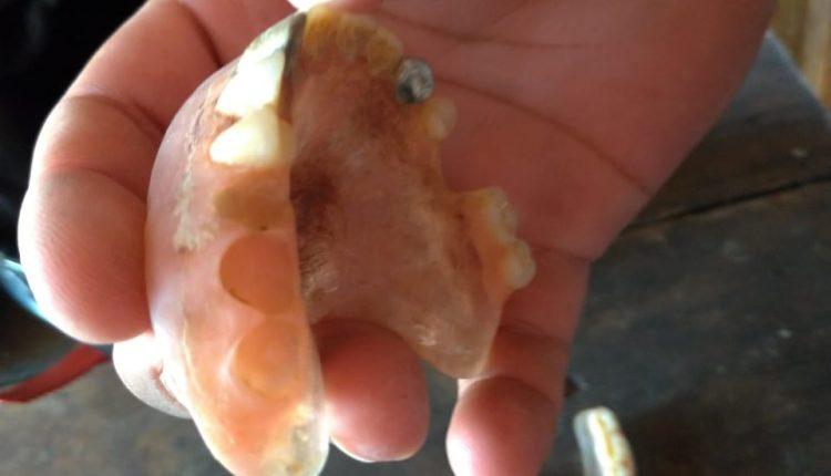 Família diz que dentes de ouro foram furtados de idoso que morreu de covid-19 em Campo Grande Família diz que dentes de ouro foram furtados de idoso que morreu de covid-19 em Campo Grande