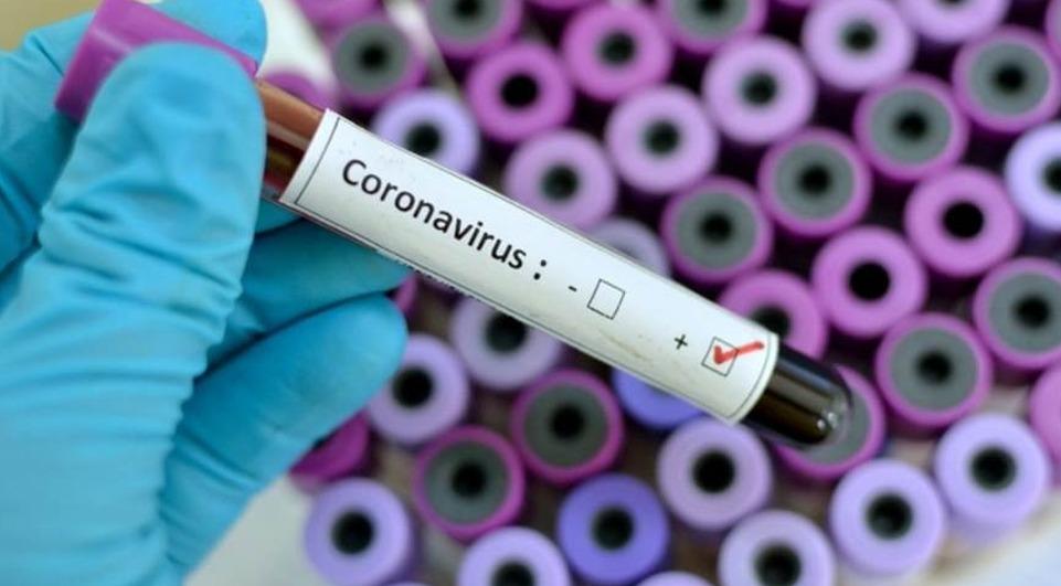 Saúde de Três Lagoas registra 13 casos positivos para Covid-19 nesta quinta-feira