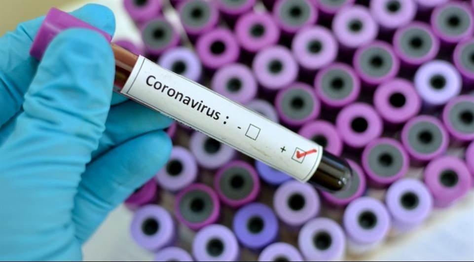 Saúde registra 14 casos positivos e 19 recuperados da Covid-19 nesta quinta-feira em Três Lagoas Saúde registra 14 casos positivos e 19 recuperados da Covid-19 nesta quinta-feira em Três Lagoas