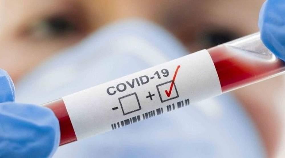 Covid-19: Saúde de Três Lagoas registra 1 morte e outros 51 novos casos positivos nesta terça-feira Covid-19: Saúde de Três Lagoas registra 1 morte e outros 51 novos casos positivos nesta terça-feira