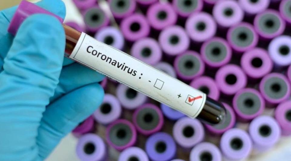 Covid-19: Três Lagoas registra 24 novos casos positivos nesta 4º feira
