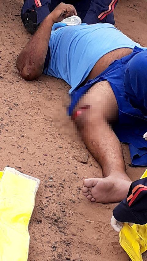 Motociclista sofre grave acidente e é socorrido pelo SAMU com fratura exposta no joelho Motociclista sofre grave acidente e é socorrido pelo SAMU com fratura exposta no joelho