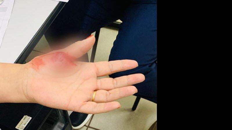 Técnica é mordida por jovem que queria atendimento rápido para a mãe na UPA em Campo Grande Técnica é mordida por jovem que queria atendimento rápido para a mãe na UPA em Campo Grande