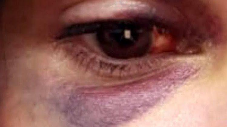 Jovem é amarrada, espancada e tem roupas rasgadas por ex ao tentar estuprá-la