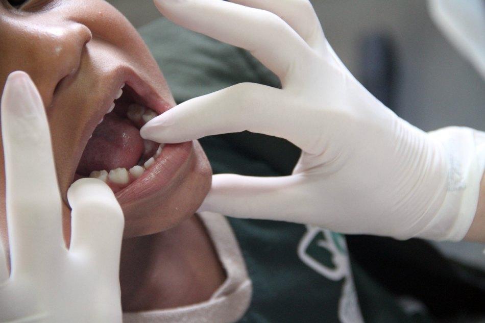 Saúde realiza ação de prevenção ao câncer bucal no próximo sábado Saúde realiza ação de prevenção ao câncer bucal no próximo sábado