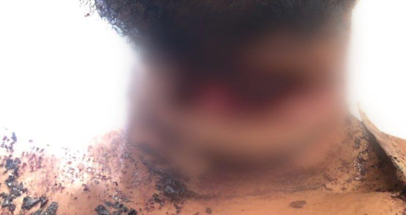 Com corte no pescoço, homem é enterrado vivo pelos colegas de trabalho em Mato Grosso do Sul Com corte no pescoço, homem é enterrado vivo pelos colegas de trabalho em Mato Grosso do Sul