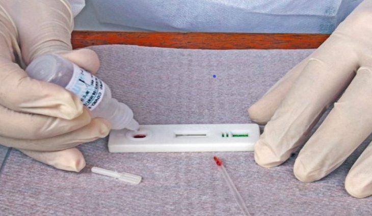 SES registra 2,6 mil casos e 16 novos óbitos por Covid